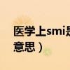 医学上smi是什么意思（医学中SMA是什么意思）