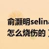 俞灏明selina烧伤事件女方怎么说的（selina怎么烧伤的）