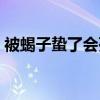 被蝎子蛰了会死吗视频（被蝎子蛰了会死吗）