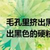 毛孔里挤出黑色硬硬的东西是什么（毛孔里挤出黑色的硬粒）