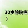 30岁膀胱癌的概率（我30岁得了早期膀胱癌）