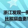 浙江发现一例稀有“恐龙血”：孟买血型系统 比熊猫血更罕见