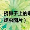 挤鼻子上的螨虫挤成坑怎么办（鼻子挤出来的螨虫图片）