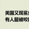 美国又现鲨鱼攻击人类案例：两男两女遇袭、有人腿被咬断