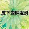 皮下囊肿发炎流脓（皮下囊肿化脓自己爆了）