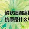 鳞状细胞癌抗原是什么意思2.0（鳞状细胞癌抗原是什么意思）