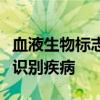 血液生物标志物可能有助于在症状出现前十年识别疾病